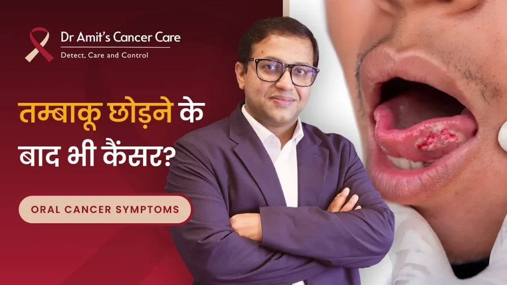Mouth Cancer Risk After Quitting Tobacco | तम्बाकू छोड़ने के बाद भी मुँह का कैंसर हो सकता है?