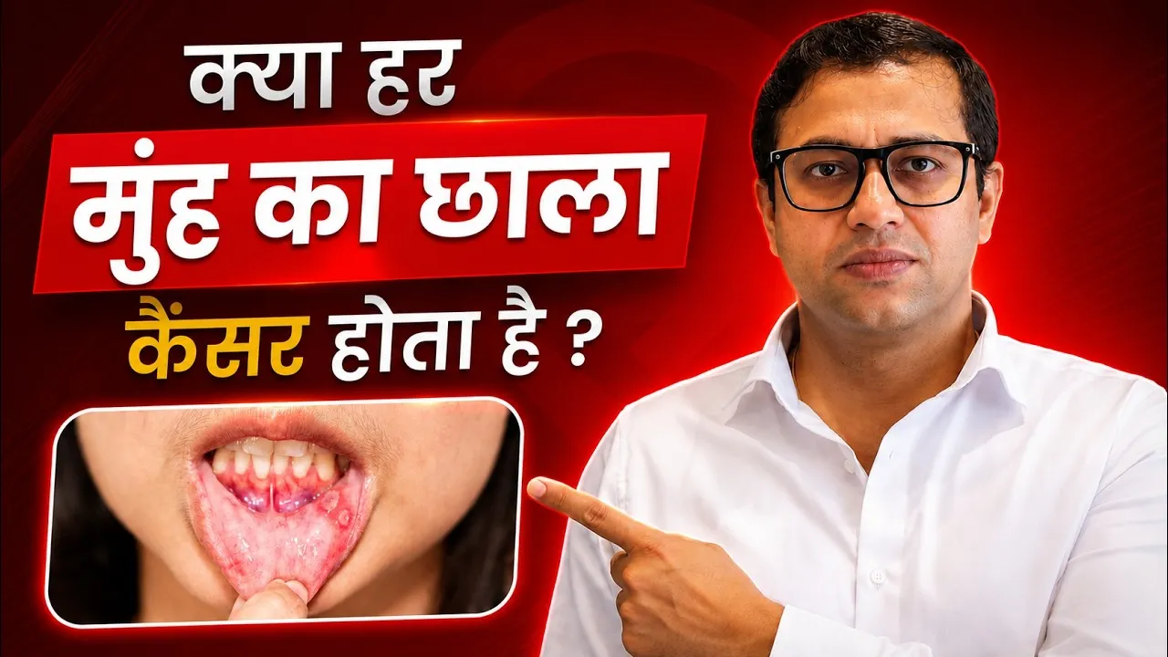क्या हर मुँह का छाला कैंसर होता है? | Is every ulcer in the mouth cancerous? | Dr Amit
